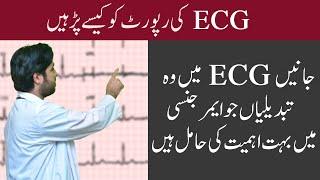 ECG - EKG | Reading ECG | How to read ECG in Urdu? | ECG Ki Report Kaise Dekhe?