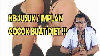 KB IMPLAN COCOK GAK BUAT DIET, BIKIN KURUS ATAU GEMUK YA