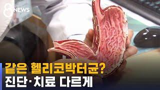 [건강라이프] 같은 헬리코박터균?…진단 · 치료 다르게 / SBS