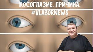 Здоровье 011. Косоглазие. Причина.  От смартфона #vlabornews