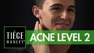 Tiege Hanley Acne System Level 2 | Tiege.com