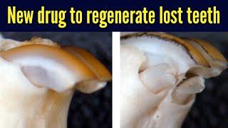 New drug to regenerate lost teeth | Antibody for USAG-1 shown to stimulate tooth growth