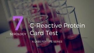 C Reactive Protein Card Test