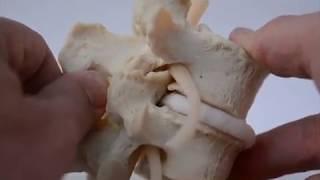 Lumbar Spinal Stenosis Dynamic Disc Model (2019 LxD model) - Product Anatomy Update