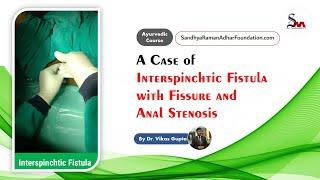 A Case of Interspinchtic Fistula with Fissure and Anal Stenosis | By Dr. Vikas Gupta | From SRAF