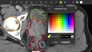 Contouring Workshop in Radiology