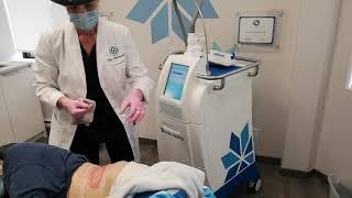 Dre Arsenault nous explique un traitement de cryolipolyse Coolsculpting