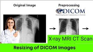 How to resize the DICOM images | Preprocessing | Processing |X ray MRI CT Scan |  ITFO