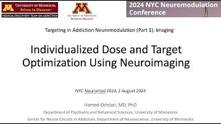 Optimization of Brain Stimulation Using Neuroimaging