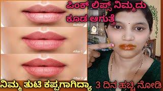 How I get rid of Pigmented Lips  REAL LIP CARE ROUTINE changes my lip colour