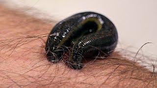 How Leeches are used in Modern Surgery | Earth Science