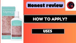 Glymed Lotion | Glymed Lotion uses side effects Benefit Review Hindi | How to use Glymed Lotion