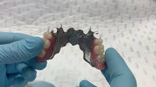 Hybrid Chrome Cobalt Denture