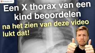 Thoraxfoto van een kind beoordelen