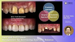 Hard and soft tissue management for achieving an aesthetic balance：Prof. Kose Yano D.D.S.,Ph.D.