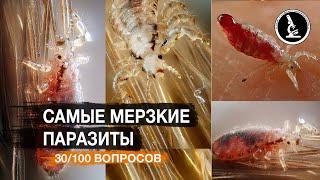 ОГРОМНЫЕ ВШИ ПЬЮТ КРОВЬ ПОД МИКРОСКОПОМ. КТО ТАКАЯ ВОШЬ?