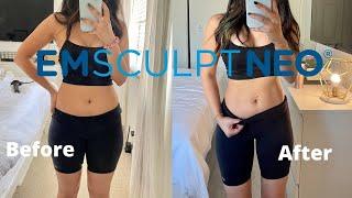 Emsculpt Neo Before After Results & Honest Review!