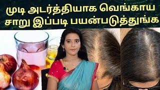 முடி அடர்த்தியாக வெங்காய சாறு இப்படி பயன்படுத்துங்க Onion juice benefits for hair growth /Dr.Mythili