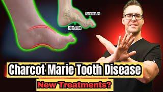 Charcot Marie Tooth Disease - Symptoms & NEW Treatments! [2024]