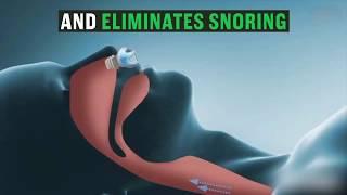 Anti Snore Technology Cidelietti Gadget Shop