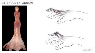 Anatomy of the Upper Limb: Extensor Expansion
