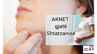 AKNET GJATE SHTATZANISE | Si sherohen aknet e shtatzenise | Shtatzania dhe aknet | Maskat natyrale |