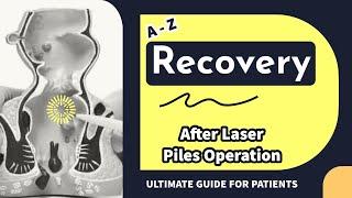 START TO END recovery POINTS after Laser Piles Operation ? Laser Haemorrhoidoplasty ?