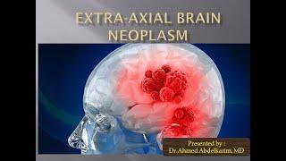 12-Extra-axial brain neoplasm