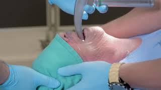 3. Oral Intubation - TNS Trauma Procedure Video Series