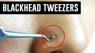 Tweezers That Remove Blackheads! TINA TRIES IT