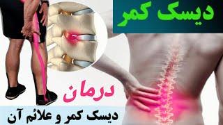 چگونه دیسک کمر را درمان کنیم!؟ |what is the treatment for disc herniation| #fitness #کمردرد #درمان