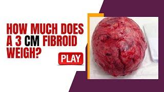 How Much does a 3 CM Fibroid Weigh? [Find Out]