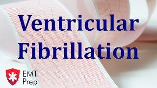 Ventricular Fibrillation ECG - EMTprep.com