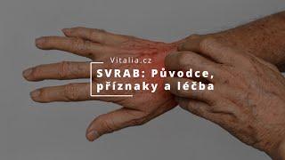 SVRAB (SCABIES): Původce, příznaky a léčba