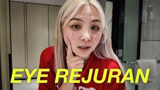 i got skincare treatment in korea