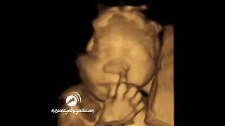 amaizing baby 4D scan