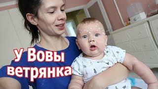 VLOG: Все таки Вова заболел ветрянкой / Хочу отстричь волосы