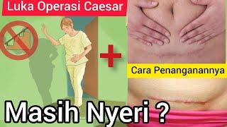 Berapa Lama Nyeri Bekas Luka Operasi Caesar Hilang ? ||Sakit Saat Luka Caesar Disentuh & Bergerak