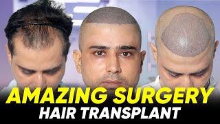 Hair Transplant in Katihar | Best Results & Cost of Hair Transplant in Katihar