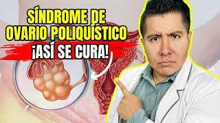 ¿Por qué TENGO SÍNDROME de OVARIO POLIQUÍSTICO? | Mr Doctor