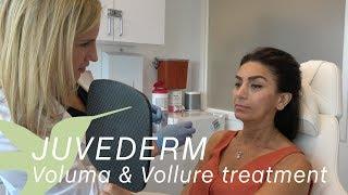 Juvederm Voluma & Juvederm Vollure Treatment Demonstration - Skin by Lovely