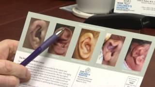 EAR MOLDING FOR BABIES