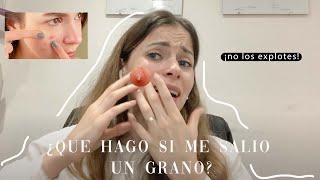 ME SALIÓ UN GRANO, QUÉ DEBO HACER? | Dermatóloga responde