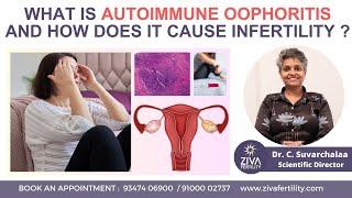 Autoimmune Oophoritis And Infertility | IVF | ICSI | Dr C Suvarchala | Ziva Fertility