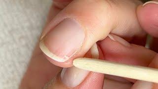 How to fix a cracked natural nail. [Pro Nail Technician explains]