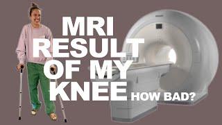 Results from the MRI..