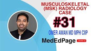Musculoskeletal (MSK) Radiology CASE #31