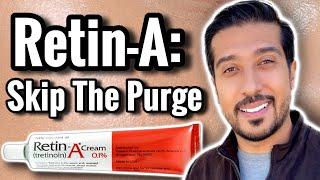 Avoid Skin Purging with Retinoids and AHA's | 5 Steps to PREVENT SKIN PURGING