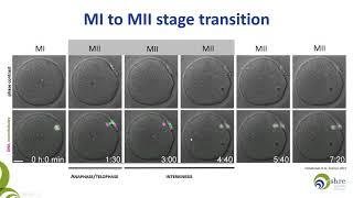 The importance of being mature   Oocyte maturity assessment in clinical practice