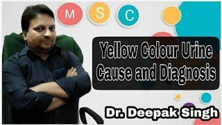  Yellow Colour Urine Cause and Diagnosis # Yellow Uresis # Dr. Deepak Singh # Practice of Medicine